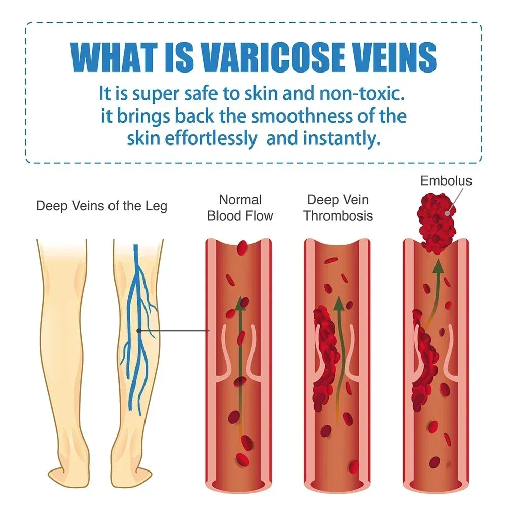 Blue Light Laser Therapy Pen - Image 6