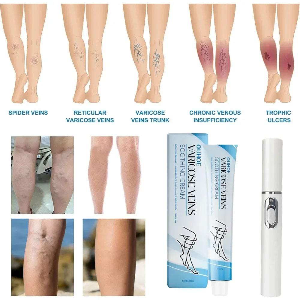 Blue Light Laser Therapy Pen - Image 4